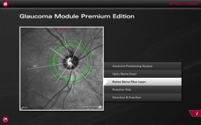 SPECTRALIS OCT screenshot 3