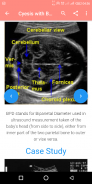 A-Z Obstetrics Ultrasound Guid screenshot 2