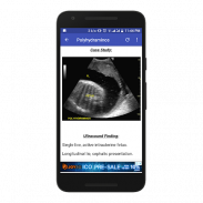 Obstetrics & Gyenacology Ultrasound Guide screenshot 4