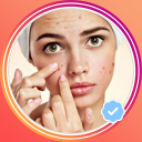 Acne Removal Video