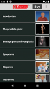 Benign Prostatic Hyperplasia screenshot 1