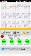 تشخيص القلب (معدل ضربات القلب، انتظام ضربات القلب) screenshot 2