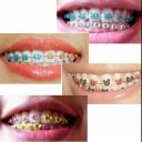 Braces Design