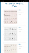 Diagnose ECG screenshot 6