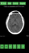 Radiology CT Viewer screenshot 0