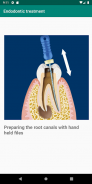 Dental diagnosis & patient education aid - Dentalk screenshot 7