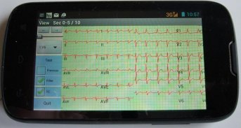 Mobile ecg recording screenshot 7