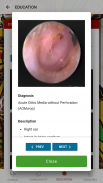 Otitis Media Guidelines screenshot 22