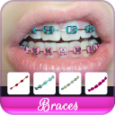 Braces Colors Beauty