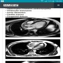 CardioMRI