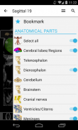 e-Anatomy screenshot 11