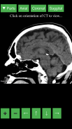 Radiology CT Viewer screenshot 1