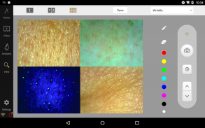 Artistry Skin Analyzer screenshot 0