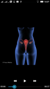 Gynecology-Animated Dictionary screenshot 5