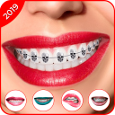 Braces 2019 - Braces Yourself Prank - Baixar APK para Android | Aptoide