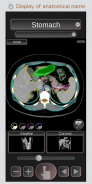 CT PassportLite Abdomen / sectional anatomy / MRI screenshot 0