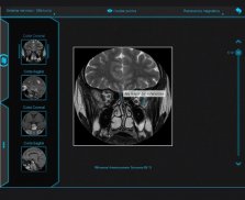 Atlas de Anatomia Radiológica screenshot 3