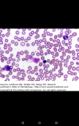 Lichtman's Atlas of Hematology screenshot 6