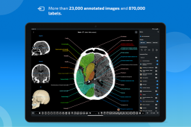 e-Anatomy screenshot 2