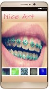 Braces Photo Editor - Braces For Your Teeth screenshot 2