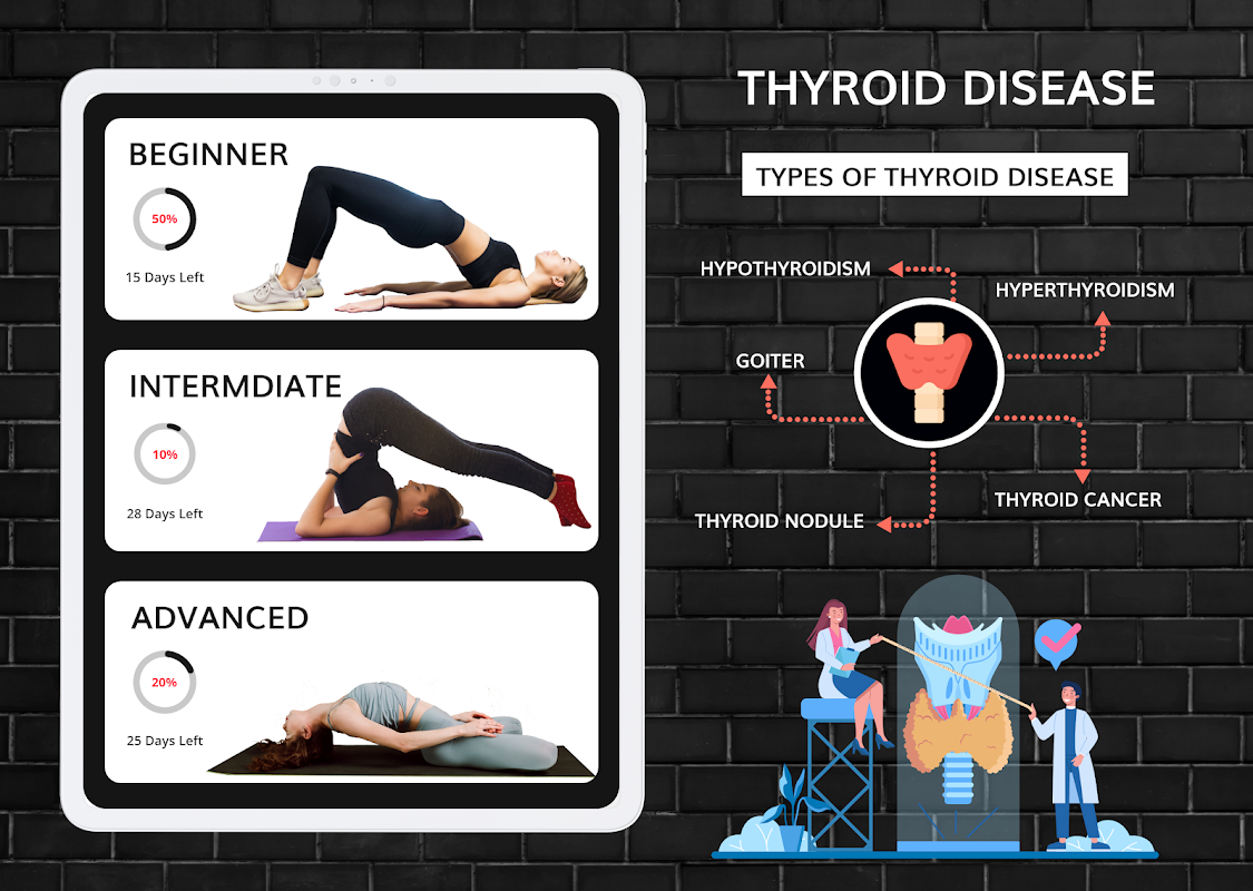 World Thyroid Day: 3 Yoga asanas that will help improve your thyroid  function, boost metabolism | Health Tips and News