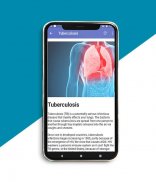 Respiratory Diseases and Treatments screenshot 1