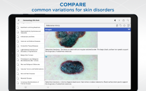 Dermatology DDx screenshot 2