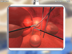 SimuSurg screenshot 9