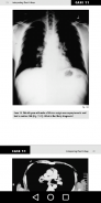 Medical X-Ray Interpretation with 100+ Cases screenshot 3
