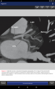 Cardiac Surgery in the Adult, 5th Edition screenshot 18