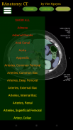 Radiology CT Anatomy screenshot 1