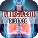 Tuberculosis: Causes, Diagnosis, and Management