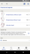AO/OTA Fracture Classification screenshot 7