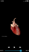 Cardiology-Animated Dictionary screenshot 8