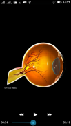 Ophthalmology -Pocket Dict. screenshot 3