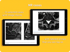 MRI Essentials screenshot 7