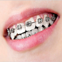 Dental Braces