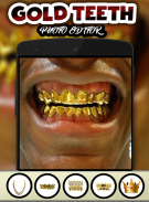 Gold Teeth Photo Editor screenshot 3