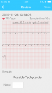 Mini ECG Aide screenshot 1