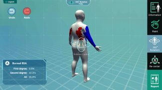 3D Ped Burn Resuscitation screenshot 1