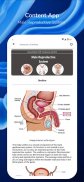 Male Reproductive System screenshot 2