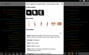 e-Anatomy screenshot 5