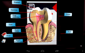 Xpert's RCT screenshot 2