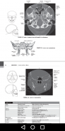 CT Scan Cross Sectional Anatomy for Imaging Pros screenshot 5