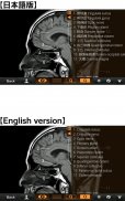 Interactive CT & MRI Anat.Lite screenshot 3