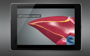 Surgical Anatomy of the Liver screenshot 2