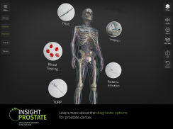 INSIGHT PROSTATE screenshot 14