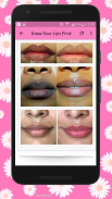 How To Get Soft Pink Lips Naturally - Lip Care screenshot 1