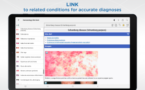 Dermatology DDx screenshot 0