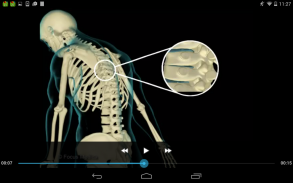 Orthopedics - Medical Dict. screenshot 6